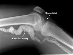 knee joint