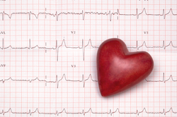 EKG diagram