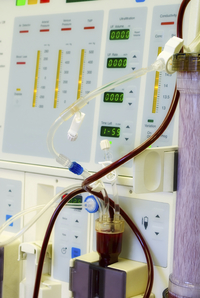 dialysis machine