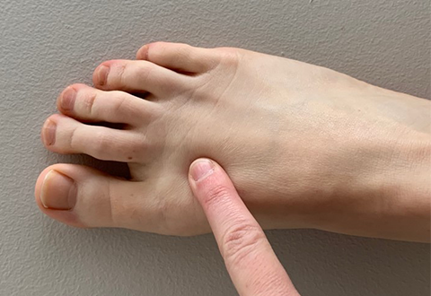 Image of a Veteran practicing self-care through acupressure, by pressing one finger into the top and middle of foot.